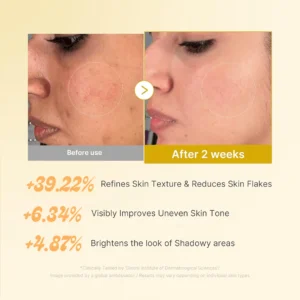 Best effective turmeric toner for glowing and radiant skin