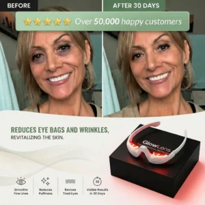 Advanced red light therapy for reducing under-eye wrinkles GlowLens