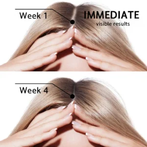 Best effective biotin serum for fast hair regrowth and strength Rolimey