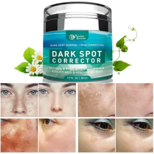 Effective spot removal cream by Yujia for sun damage and melasma