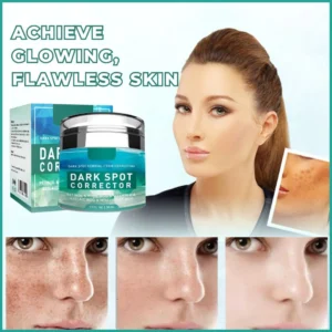 Yujia™ Melasma and Dark Spot Corrector Cream for hyperpigmentation