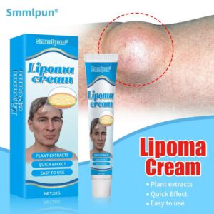 Lipoma Treatment Cream™ for reducing fatty skin lumps safely