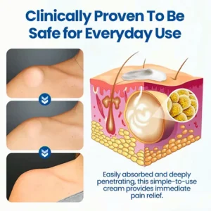Painless fatty lump removal cream for neck and back