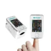 Advanced non-invasive health monitor for painless vital tracking