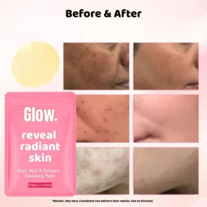 Turmeric face and body brightening bundle by Kojic