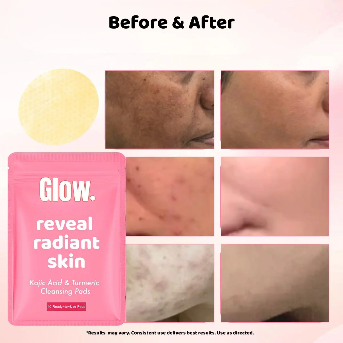 Turmeric face and body brightening bundle by Kojic