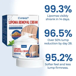 Cvreoz Lipoma Removal Cream for fatty lump reduction
