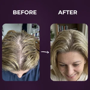 Advanced hair density serum with peptides for thicker hair