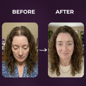 Multi-Peptide Hair Growth Serum for thinning hair and scalp health