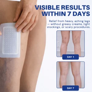 Diosmin and Hesperidin microneedle patch for leg circulation