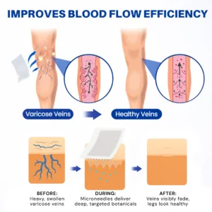 Alisanda Vein Refine microneedle patch for varicose vein relief