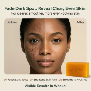 Best serum to fade dark spots and even skin tone