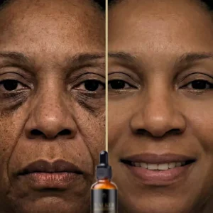 Walker Skin Protect for preventing scalp irritation from adhesives