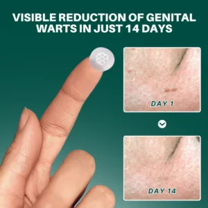 age spot corrector for brighter smoother skin