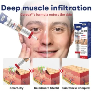 gentle skin care cream for rough raised skin areas