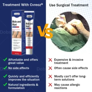 mole and wart care cream for smoother looking skin