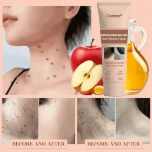 gel exfoliator for rough textured skin improvement