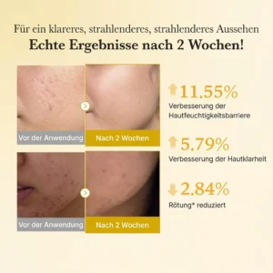 Best effective organic serum for smoothing fine lines naturally